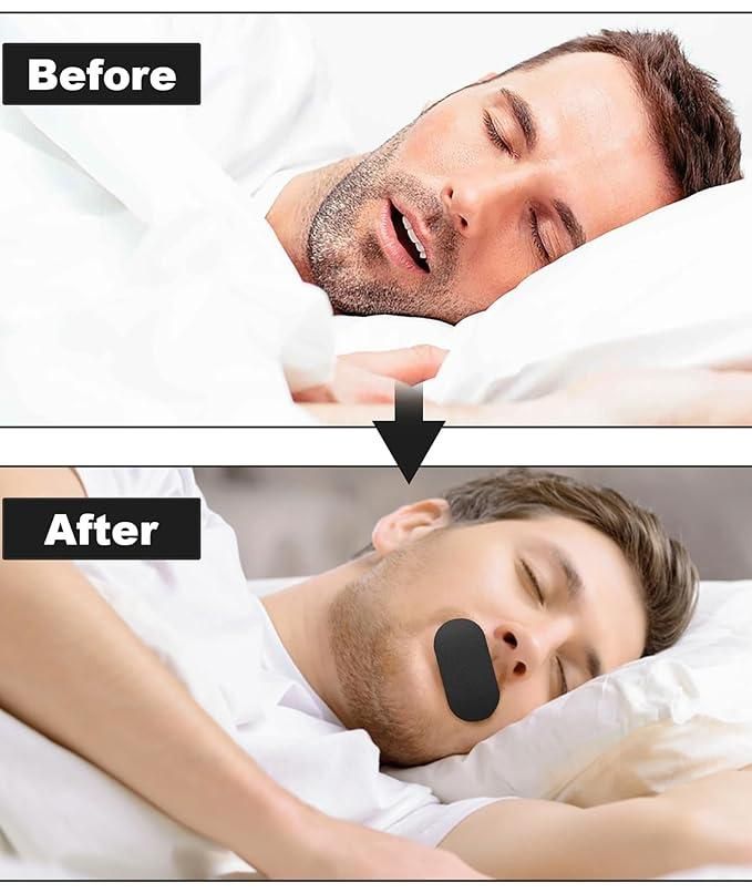 Mouth Tape Anti Snoring Patches (Pack of 15)